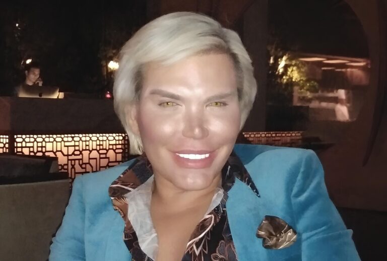 Rodrigo Alves chtěl být živým Kenem, nakonec je z něj Barbie Jessica. Kam až může člověka dohnat touha po dokonalosti